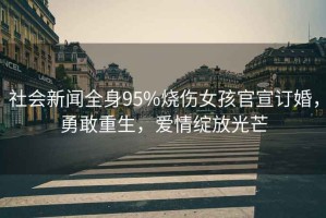 社會(huì)新聞全身95%燒傷女孩官宣訂婚，勇敢重生，愛情綻放光芒