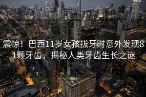 震驚！巴西11歲女孩拔牙時意外發現81顆牙齒，揭秘人類牙齒生長之謎