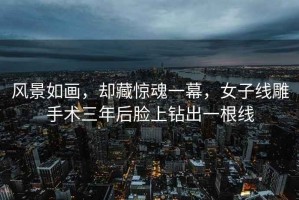 風景如畫，卻藏驚魂一幕，女子線雕手術三年后臉上鉆出一根線